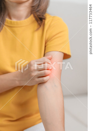 woman itching and scratching itchy arm. Sensitive Skin Allergic reaction to insect bite, food, drug dermatitis. Dermatology, Leprosy day, Systemic lupus erythematosus, Allergy symptoms and rash Eczema 117733464