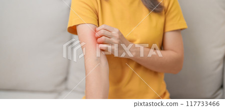 woman itching and scratching itchy arm. Sensitive Skin Allergic reaction to insect bite, food, drug dermatitis. Dermatology, Leprosy day, Systemic lupus erythematosus, Allergy symptoms and rash Eczema 117733466