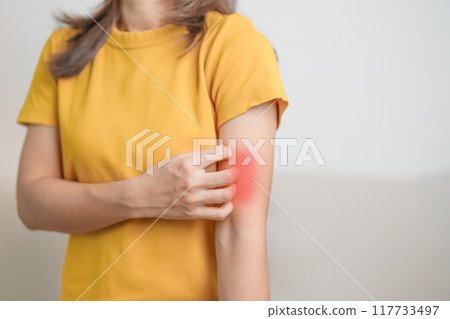 woman itching and scratching itchy arm. Sensitive Skin Allergic reaction to insect bite, food, drug dermatitis. Dermatology, Leprosy day, Systemic lupus erythematosus, Allergy symptoms and rash Eczema woman itching and scratching itchy arm. Sensitive Skin Allergic reaction to insect bite, food, drug dermatitis. Dermatology, Leprosy day, Systemic lupus erythematosus, Allergy symptoms and rash Eczema 117733497