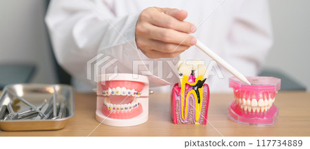 Tooth Anatomy and Orthodontic model on dentist table. Oral Teeth and disease. March Oral health, Dentist Day, False Teeth. Toothache and Children Dental Health Month and May Orthodontic Health Day Tooth Anatomy and Orthodontic model on dentist table. Oral Teeth and disease. March Oral health, Dentist Day, False Teeth. Toothache and Children Dental Health Month and May Orthodontic Health Day 117734889