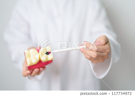 Dentist with tooth Anatomy model. Oral Teeth decay and disease, Scrape off tartar. March Oral health, Dentist Day, False Teeth. Toothache and Children Dental Health Month and Orthodontic Health Day 117734972