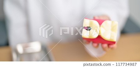 Dentist with tooth Anatomy model. Oral Teeth decay and disease, Scrape off tartar. March Oral health, Dentist Day, False Teeth. Toothache and Children Dental Health Month and Orthodontic Health Day 117734987