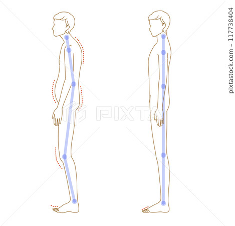 Illustration set of floating toes and normal soles (poor posture of a man's whole body) 117738404
