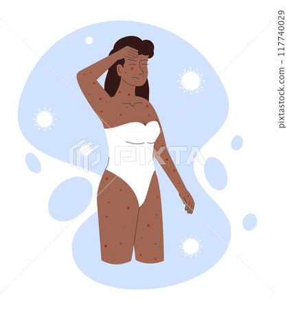Woman suffering with rashes on all body, mpox virus. Monkeypox virus concept. New orthopox virus Woman suffering with rashes on all body, mpox virus. Monkeypox virus concept. New orthopox virus 117740029