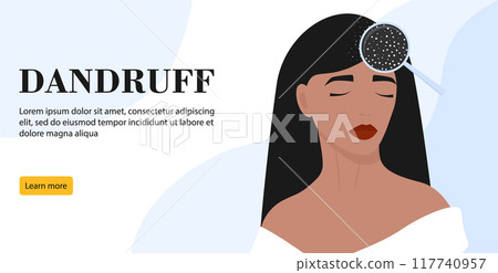 Women's dandruff problem on the head banner. Hair scalp problem. Fungal skin disease Women's dandruff problem on the head banner. Hair scalp problem. Fungal skin disease 117740957