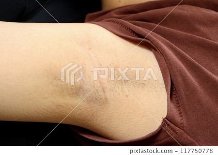 一段時間沒有處理過的女人腋毛 一段時間沒有處理過的女人腋毛 117750778
