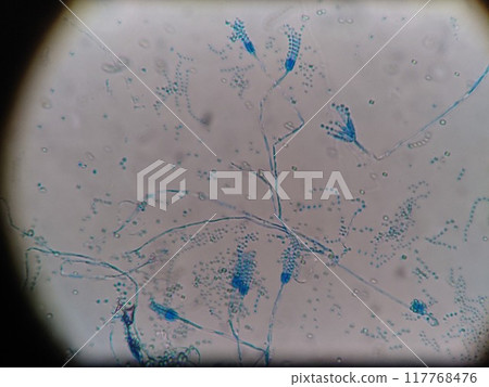 Microscopic image of blue mold, used in cheese 117768476