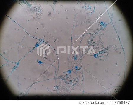 藍色黴菌的顯微照片 藍色黴菌的顯微照片 117768477