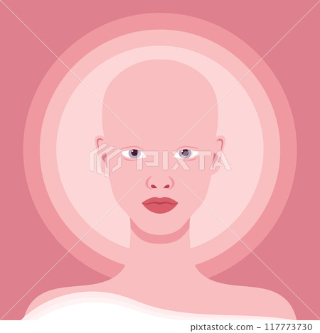 Young woman with alopecia portrait. Beautiful bald girl. Alopecia areata. Vector illustration Young woman with alopecia portrait. Beautiful bald girl. Alopecia areata. Vector illustration 117773730