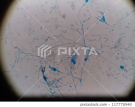 青黴菌的顯微照片 117778940