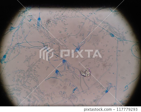 藍黴菌染成藍色的顯微照片 藍黴菌染成藍色的顯微照片 117779293