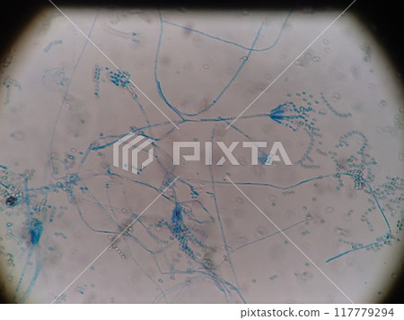 Microscopic photo of mold 117779294