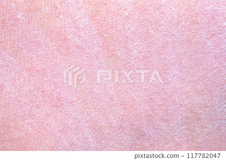 dry and dehydrated human skin texture background dry and dehydrated human skin texture background 117782047