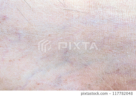 dry and dehydrated human skin texture background dry and dehydrated human skin texture background 117782048