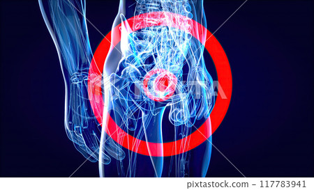 Abstract 3D illustration of the bladder cancer 117783941