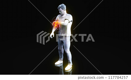 Anatomy concept of an elbow pain 117784257
