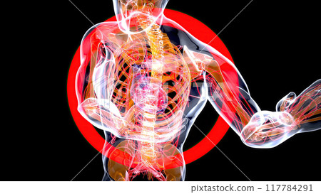 Abstract illustration of a heart attack Abstract illustration of a heart attack 117784291