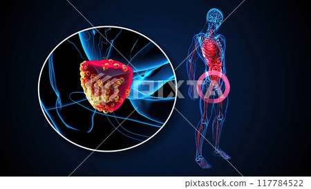 Abstract 3D illustration of the prostate Abstract 3D illustration of the prostate 117784522