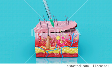 Abstract illustration of a subcutaneous injection Abstract illustration of a subcutaneous injection 117784832