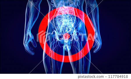 Abstract 3D illustration of the bladder cancer Abstract 3D illustration of the bladder cancer 117784918