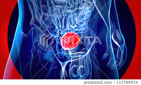 Abstract 3D illustration of the bladder cancer Abstract 3D illustration of the bladder cancer 117784919
