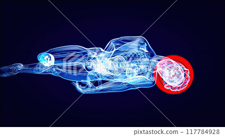 Abstract illustration of a Cyclist and a concussion 117784928