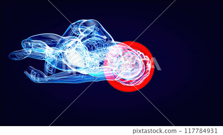 Abstract illustration of a Cyclist and a concussion 117784931