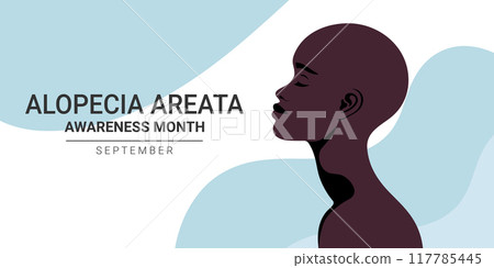 Alopecia Areata awareness month banner. Beautiful African bald woman. Vector illustration 117785445