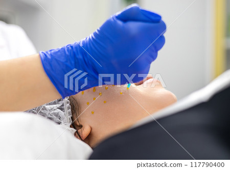 Close-up of the process of applying a yellow solution to the client's face during a cosmetic procedure. Cosmetic medicine process. 117790400