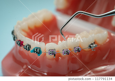 Dental teeth model with dentist tool for dentistry. Dental teeth model with dentist tool for dentistry. 117791134
