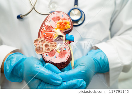 Kidney disease, Chronic kidney disease ckd, Doctor hold human model to treat and study in hospital. Kidney disease, Chronic kidney disease ckd, Doctor hold human model to treat and study in hospital. 117791145