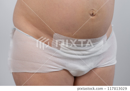 Close-up of a woman's belly after a caesarean section.  117813029