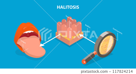 3D Isometric Flat Vector Illustration of Halitosis, Bacterial Causes of Bad Breath 117824214