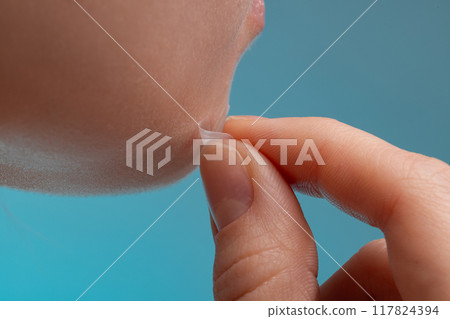 Girl with acne stick round acne patch on her cheek. Using acne patches for treatment of pimple and rosacea close-up. Facial rejuvenation cleansing cosmetology Girl with acne stick round acne patch on her cheek. Using acne patches for treatment of pimple and rosacea close-up. Facial rejuvenation cleansing cosmetology 117824394