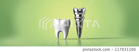 dental implant structure from stainless steel surgical instruments 117831100