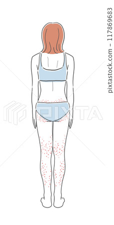 下半身皮膚粗糙的女人背後插畫素材 117869683