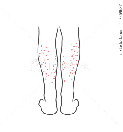 皮膚粗的女人小腿插畫素材 皮膚粗的女人小腿插畫素材 117869687