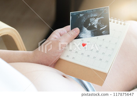 Pregnant women should prepare for childbirth by attending prenatal classes, packing a hospital bag, and arranging transportation. It essential to have a birth plan, ensure all necessary documents 117875647