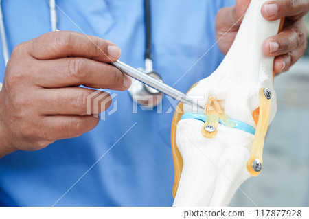 Asian doctor holding spinal nerve and bone model, Lumbar spine displaced herniated disc fragment for treatment medical in the orthopedic department. 117877928