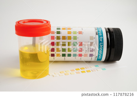 Urinalysis, urine cup with reagent strip pH paper test and comparison chart in laboratory. Urinalysis, urine cup with reagent strip pH paper test and comparison chart in laboratory. 117878216