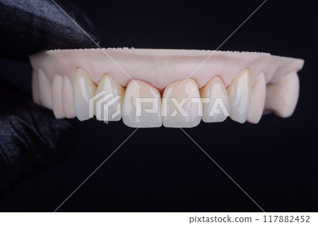 Dental zirconia crowns on hand in black glove. Painted monolithic teeth crowns by stains for ceramic 117882452