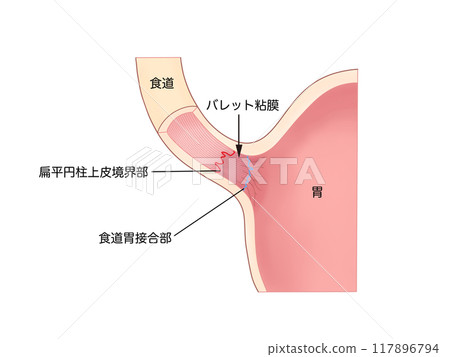 Anatomy and Physiology of the Digestive System: Barrett's Esophagus 117896794