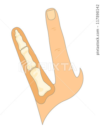 Bones type skeleton. Educational anatomical diagram element. Bone example. Educational medical vector illustration Bones type skeleton. Educational anatomical diagram element. Bone example. Educational medical vector illustration 117898142