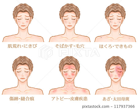患有皮膚病和皮膚粗糙的成年男性插畫素材集 117937366
