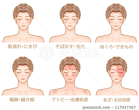 患有皮膚病和皮膚粗糙的成年男性插圖資料集2 117937367