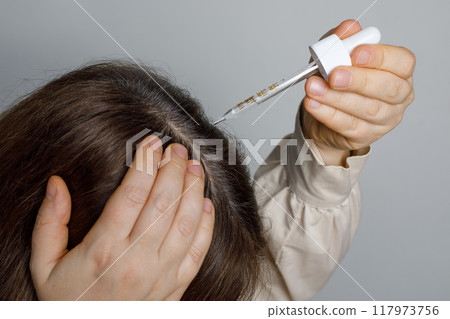Woman with baldness treatment. Male person applying dermatology cosmetic.  117973756