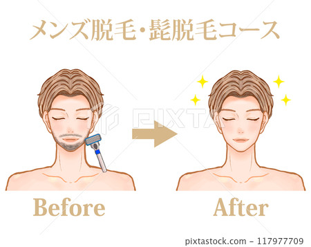 Illustration material of an adult man before and after undergoing men's hair removal at a men's beauty salon Illustration material of an adult man before and after undergoing men's hair removal at a men's beauty salon 117977709