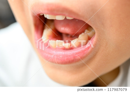 tooth falls out 117987079