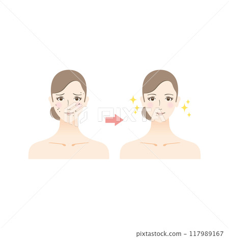 Beauty illustration: Before and after of a woman suffering from a mole 117989167
