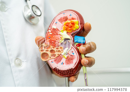 Cardiovascular disease CVD, Asian doctor holding human anatomy model for learn and treat heart disease. 117994378